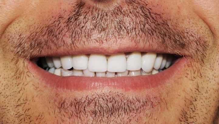 dantų problemos sukelia svorio kritimą riebalus deginantys dumbliai