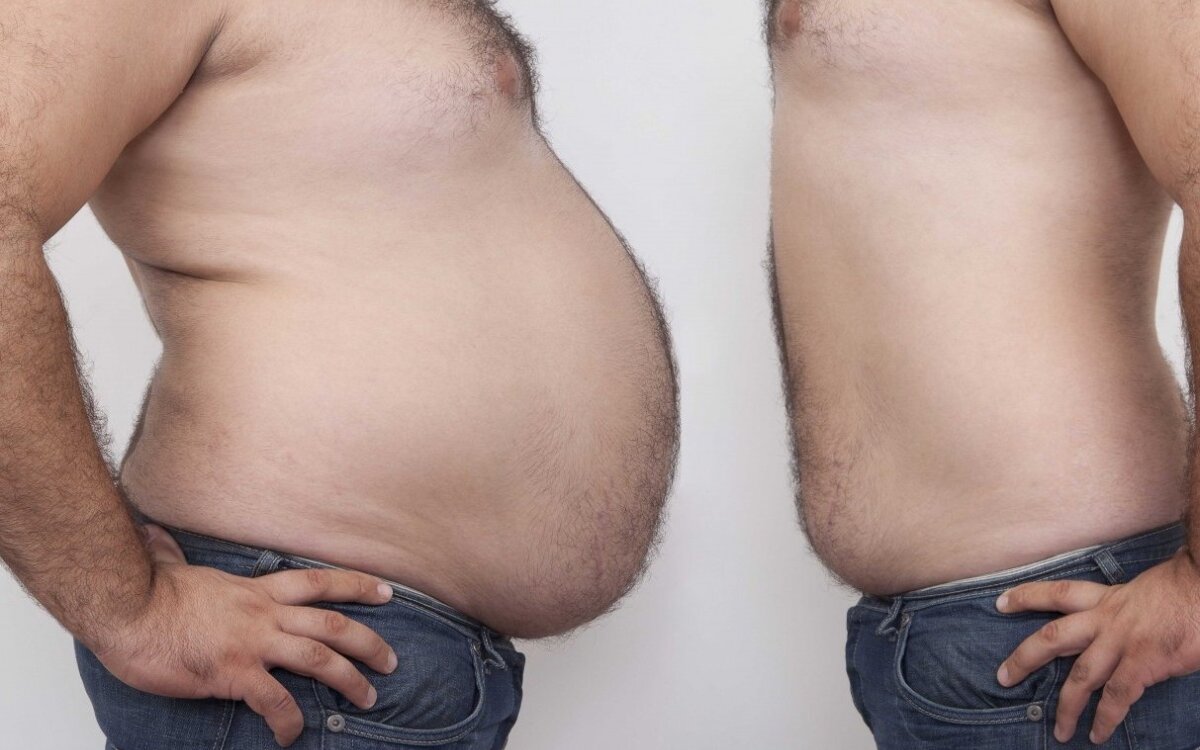 mesti svorį būdamas 60 vyrų paprasti būdai numesti krūties riebalus