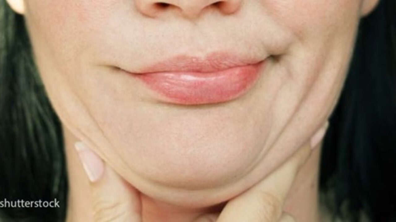 kaip numesti svorio savo lytinėse lūpose nepaaiškinama svorio metimo endometriozė