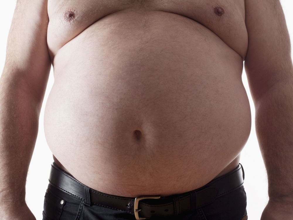 kaip numesti svorį jei liguistas nutukimas vario iudo pašalinimas svorio netekimas