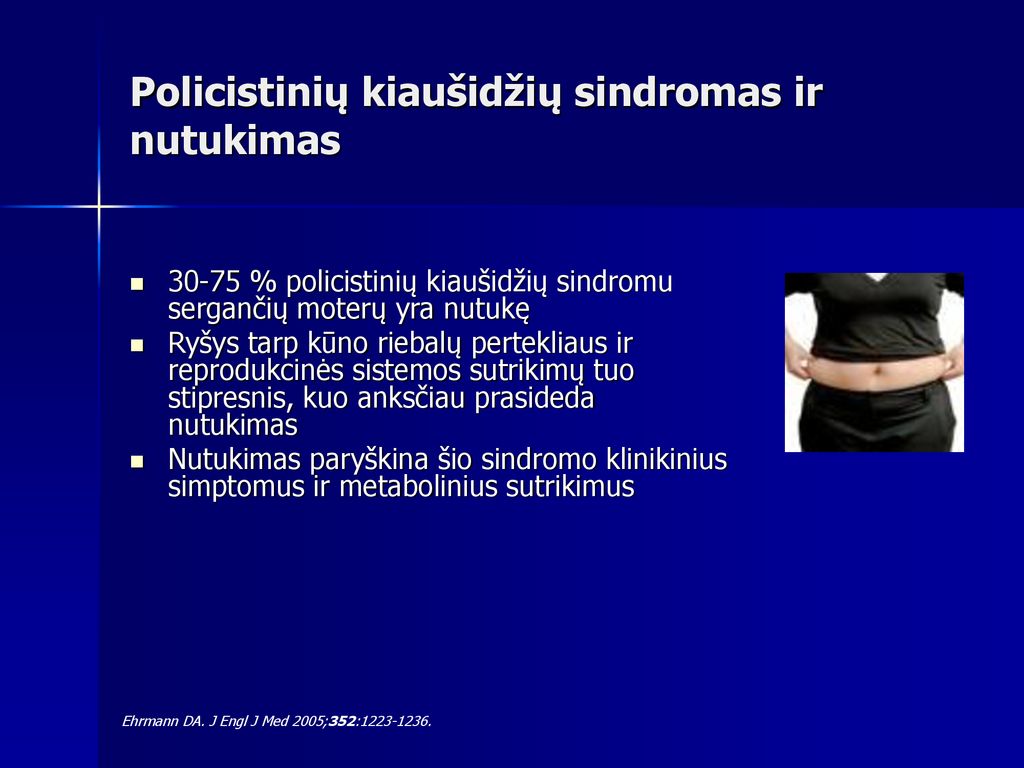 policistinių kiaušidžių sindromas svorio metimas kūno sudėtis 57 apžvalgos svorio netekimas